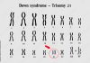 Down Syndrome in Animals: Genetic Insights and Welfare Considerations A human karyotype illustrating Trisomy 21 clearly showing the extra copy of chromosome 21