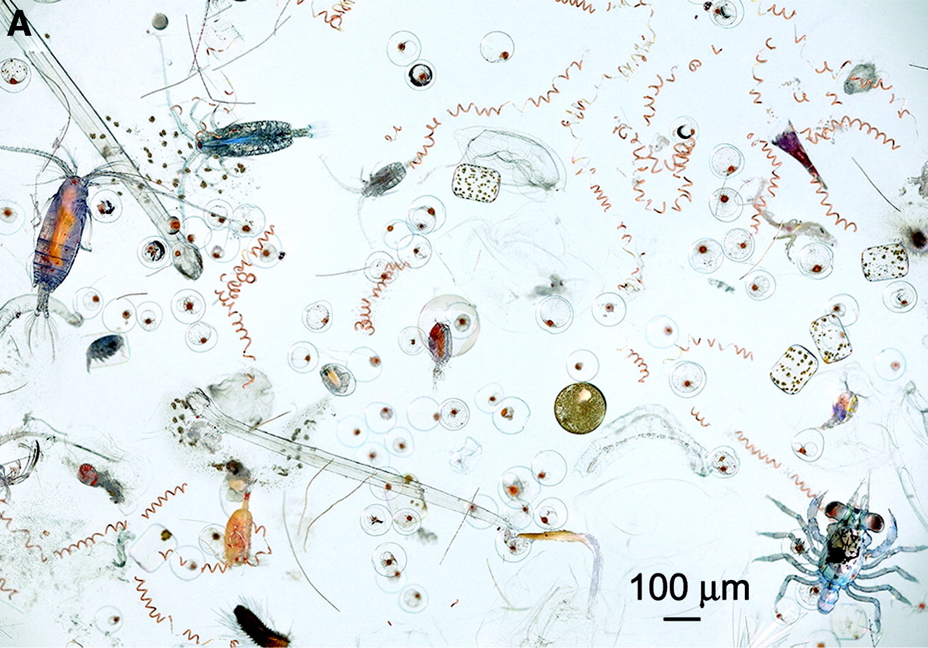 A vibrant image of various types of marine plankton viewed under a microscope