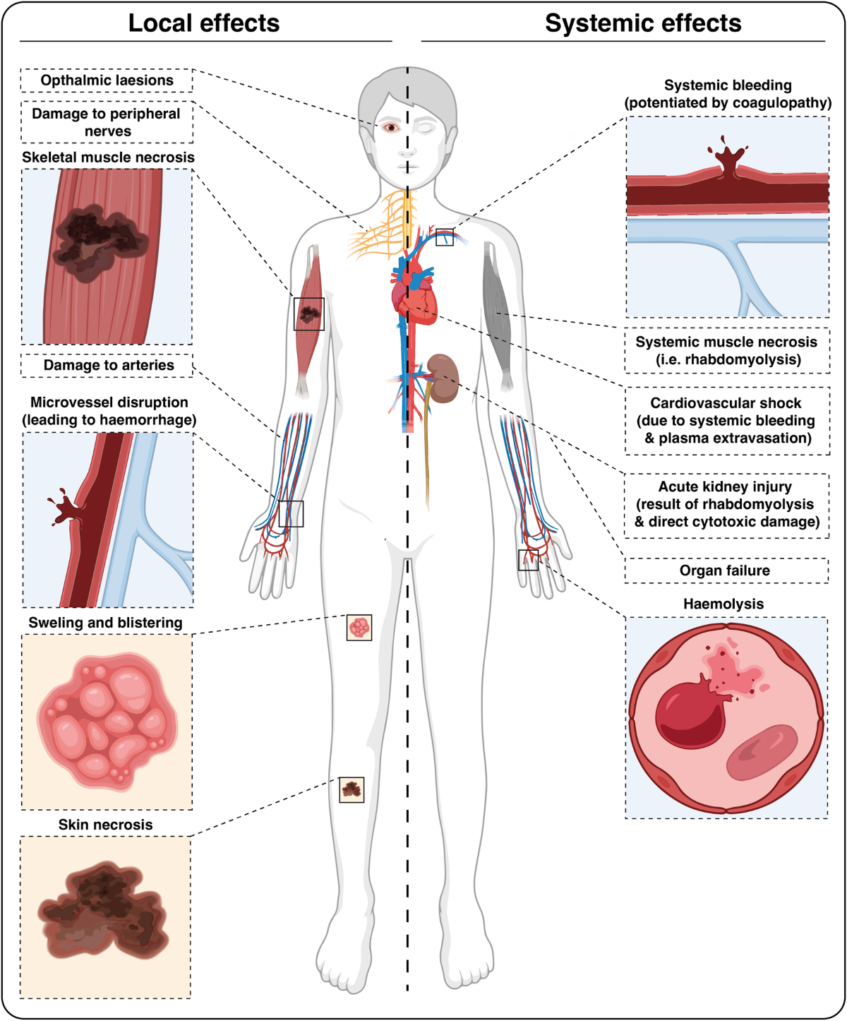 Diagram showing the effects of venom on the human body